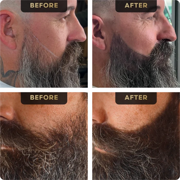 Baldr's Beard Pen, image 2. The Beard Struggle