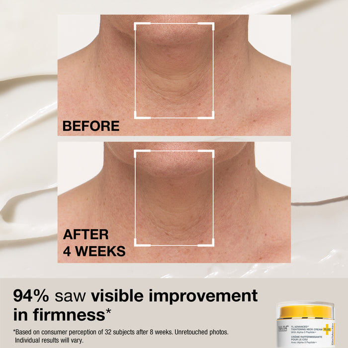 Neck Essentials: Tighten & Lift Set