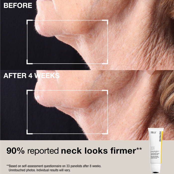 Neck Essentials: Tighten & Lift Set