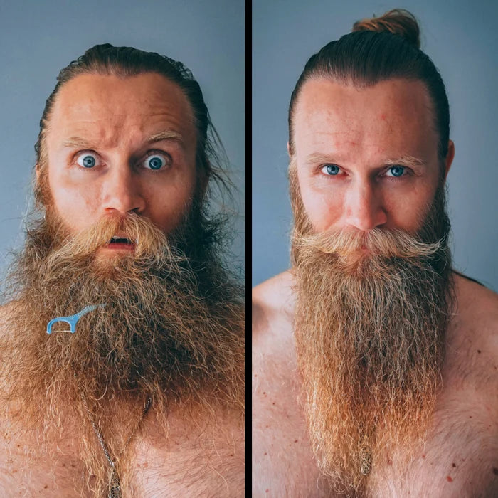 Ultimate Carbon X Beard Kit, image 4. The Beard Struggle